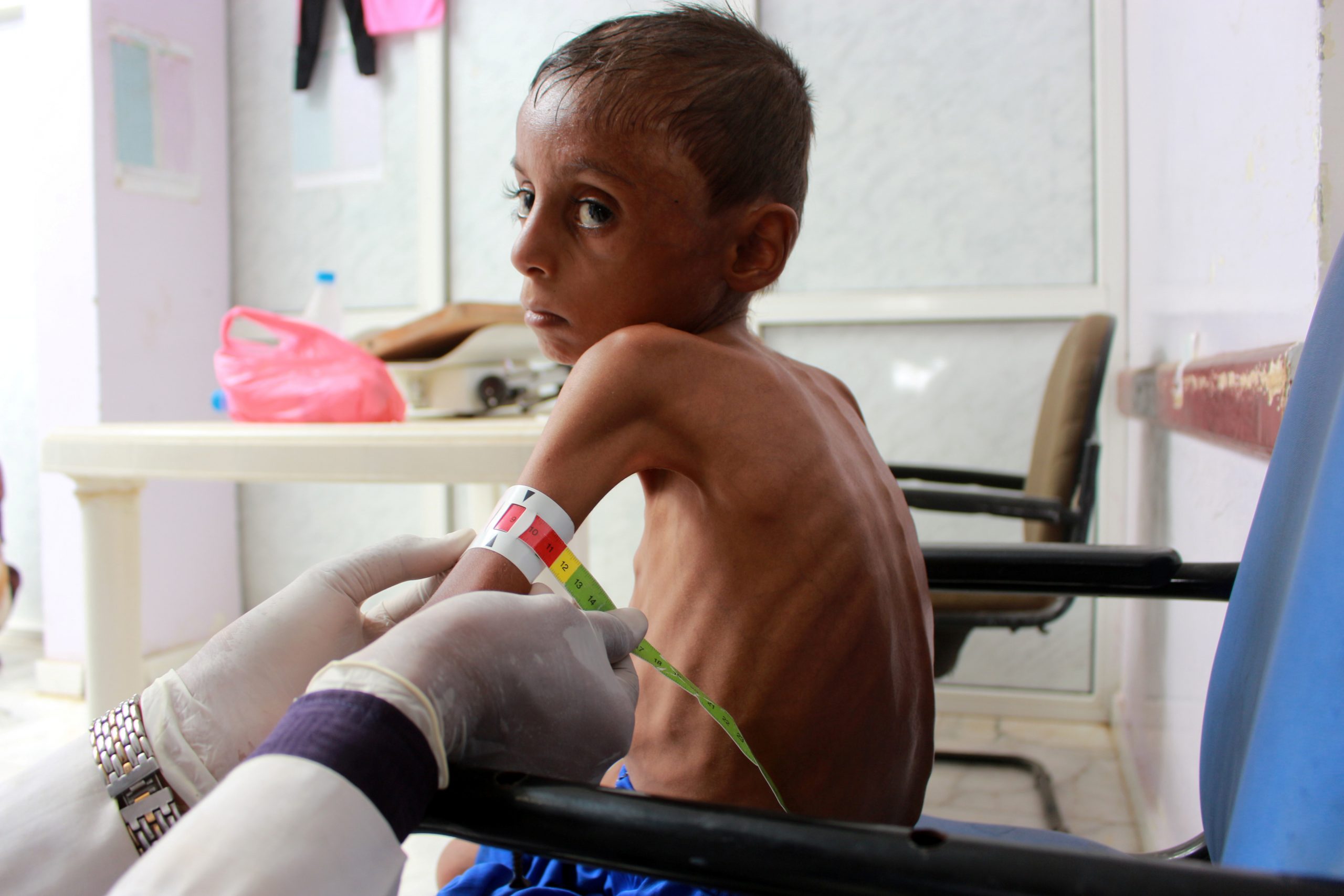 Yemen Famine Resurfacing Amid COVID-19