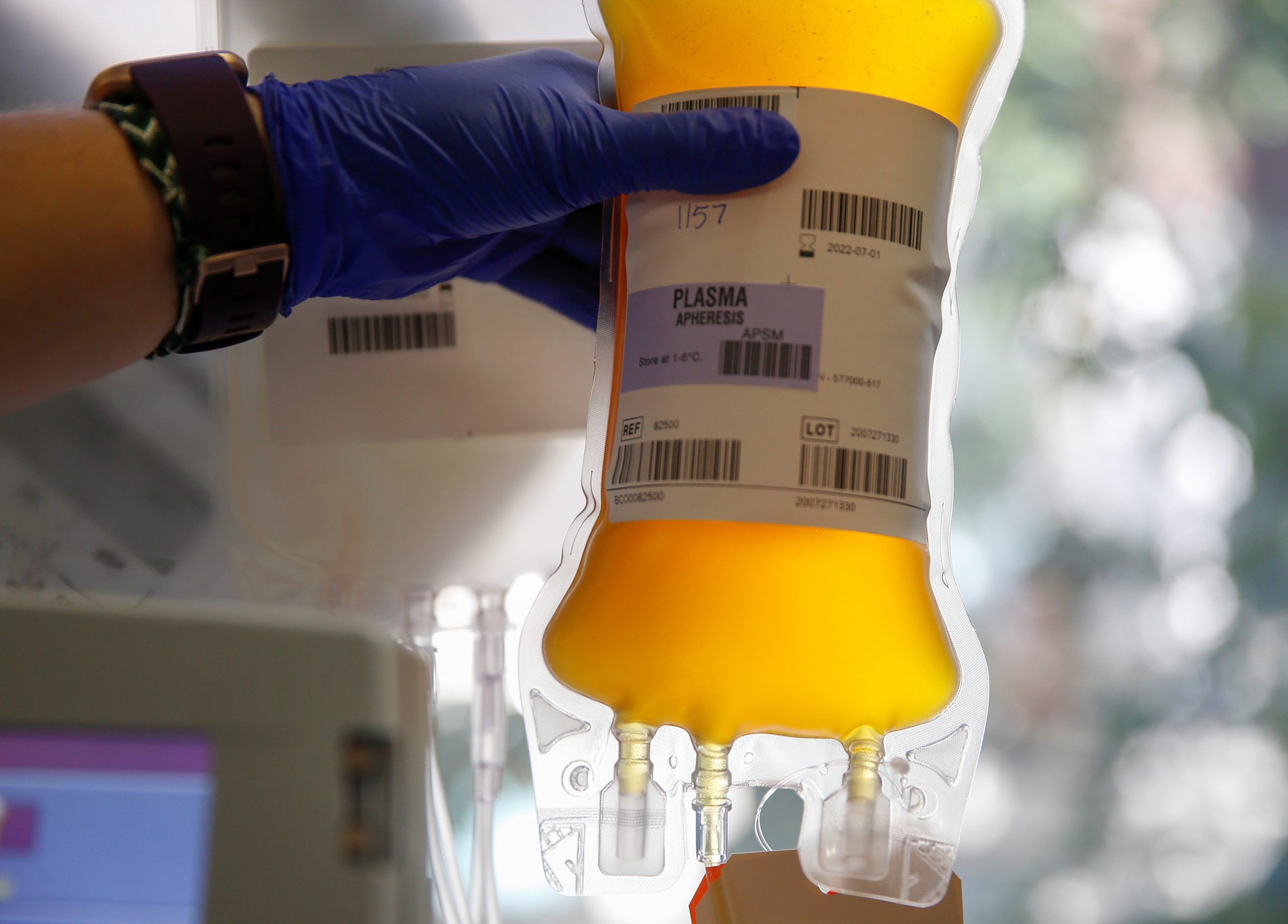 Trial Of COVID-19 Blood Plasma Finds No Benefit In Severely Ill Patients