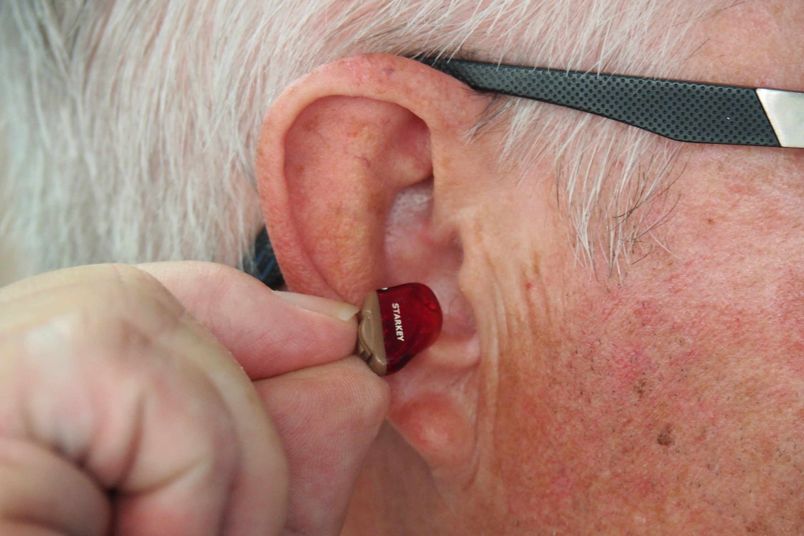 U.S. approves sale of over-the-counter hearing aids, potentially lowering costs