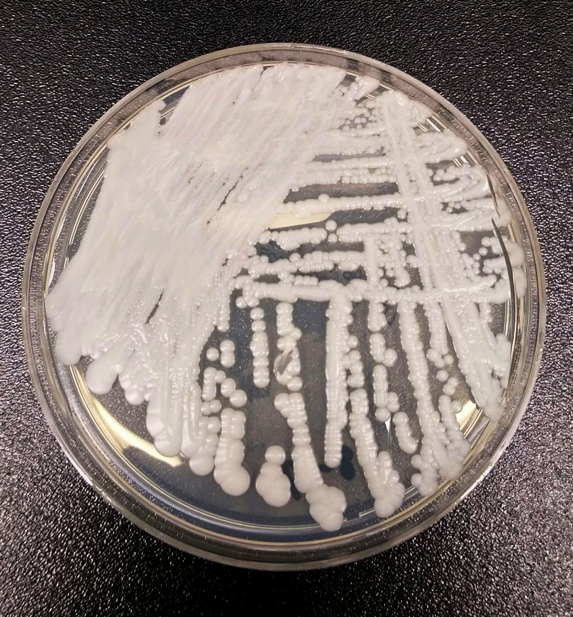 CDC says deadly fungus is an ‘urgent threat’