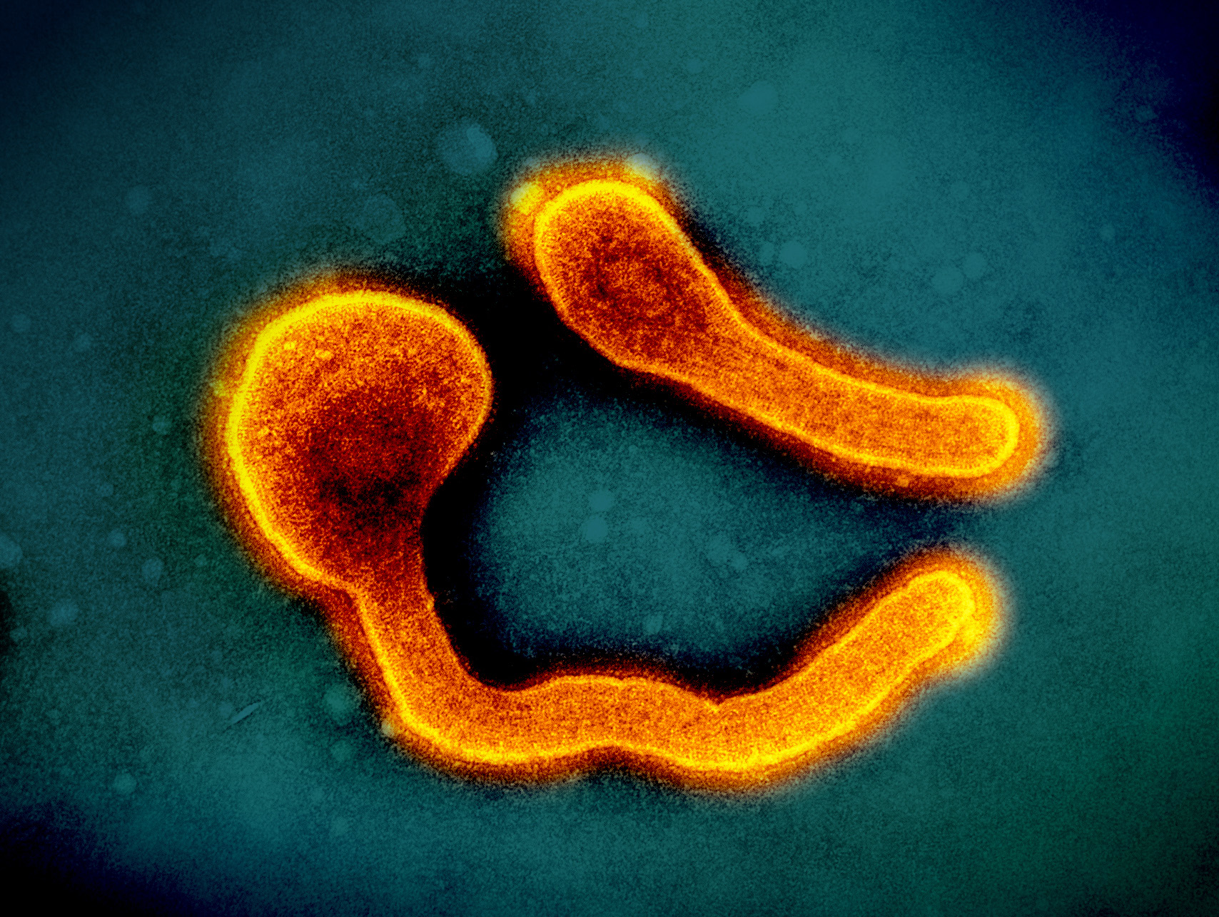 Ebola-like Marburg virus linked to deadly outbreaks in two African nations