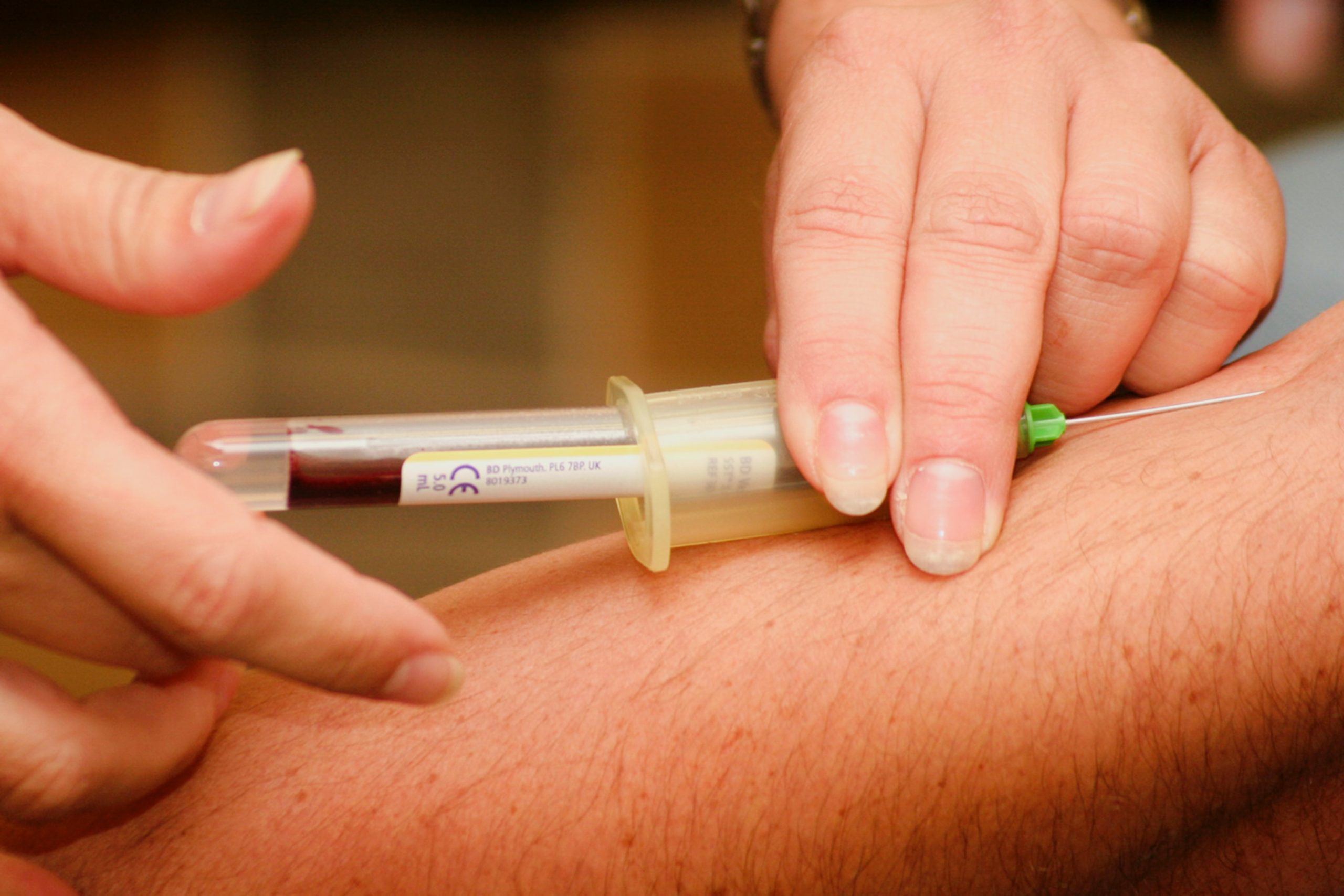 FDA proposes change to blood donation rules for gay and bisexual men